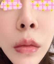 点击看大图 体验后-天津伊美尔医疗整形美容专科医院