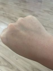 -清疣美疣·痣·斑净肤中心