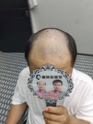 -唐风采假发补发定制