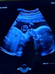 -郑州万安妇产医院