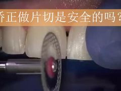 -团圆口腔·种植中心(锦江院区)