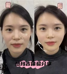 -上海伊莱美医疗美容医院
