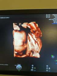 点击看大图 -杭州贝瑞斯美华妇儿医院·早孕·产检·儿科