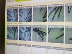 -LESSMORE科技头皮理容中心