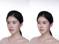 -Yestar艺星医疗美容医院