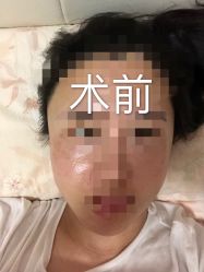 -深圳鹏爱悦心医疗美容医院