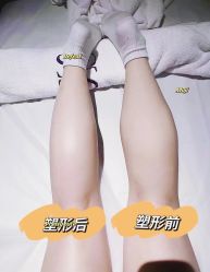 -Lily纤美·科技减脂中心