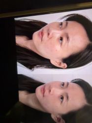 点击看大图 -Yestar杭州艺星医疗美容医院