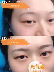-西施无菌半永久纹绣眉眼影唇轻增发纹发际线