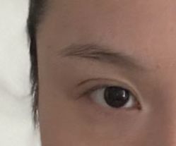 -广州美莱医疗美容医院