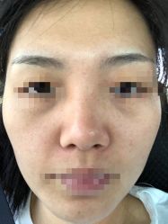 -西安现代妇产医院医疗美容