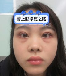 -素美医疗美容·西南眼鼻整形·修复基地