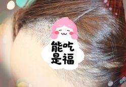 -大麦微针植发全国连锁