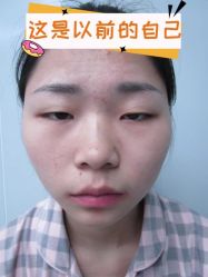 -素美医疗美容·西南眼鼻整形·修复基地