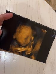 -北京俪婴妇产医院(朝阳大悦城店)