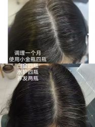 -诗碧曼养发
