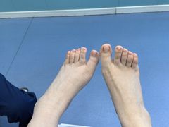 -Andrew指甲专科灰指甲·甲沟炎矫正·3D步态矫形鞋垫定制(浦三路店)