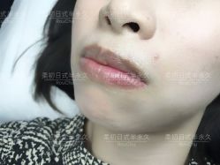 -RC半永久纹眉纹发际线