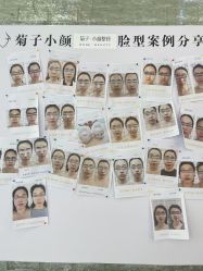 -菊子小颜·日式整骨·产后管理