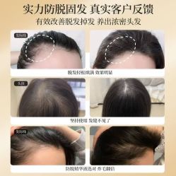 -诗碧曼养发