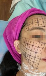 -北京米扬丽格医疗美容·联合丽格鼻整形中心