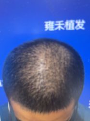 -雍禾植发全国连锁