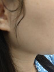 -美瑞莎创美医疗美容