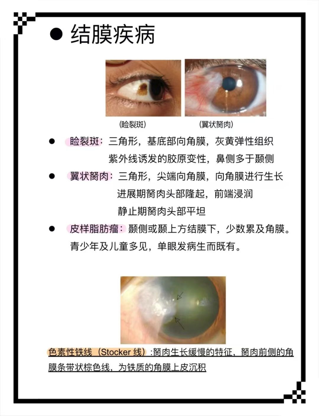 揭秘眼睛背后的故事