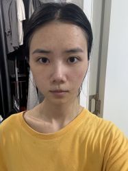 -广州健丽·去眼袋医疗美容机构