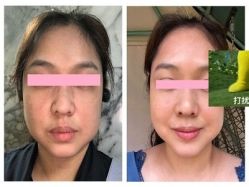 -SKINIST丽铂医疗美容