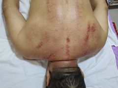 -深蓝盲人按摩中心(西北旺店)