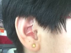 聆客561佩戴效果图瑞声达助听器宝山店-宁耳听力助听器奥迪康·峰力·西门子(宝山店)