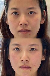 -Yestar 嘉兴艺星医疗美容医院