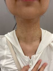 -美瑞莎创美医疗美容