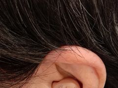 -安湃声助听器(密云店)