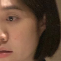 体验前-比华利美容医院