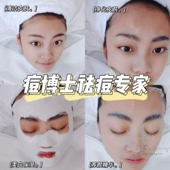 -悟空祛痘·诺奖技术专业店