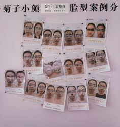 -菊子小颜·日式整骨·产后管理