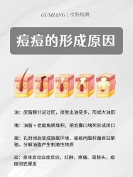 -克丽缇娜