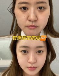 -Yestar艺星医疗美容医院
