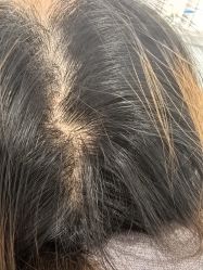 -熙朵美学植发·连锁品牌