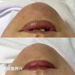 -LUNA皮相美·骨相美高级美感