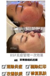 -E.beauty驻颜·痘敏肌调理中心