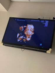 -杭州贝瑞斯美华妇儿医院·早孕·产检·儿科