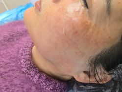 -长沙雅美医疗美容医院