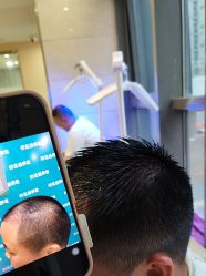 -碧莲盛·不剃发植发