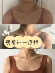 -上海漾颜医疗美容