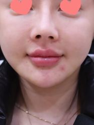 -郑州米兰柏羽集美医疗美容医院