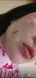 点击看大图 体验后-杭州奥拉克医疗美容门诊部