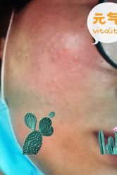 -深圳鹏爱悦心医疗美容医院